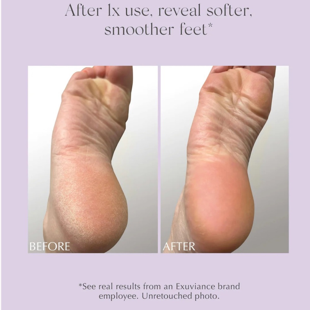 Exuviance Exfoliating & Conditioning Foot Balm 50 g/ 1.7 oz Never Used - Picture 5 of 11